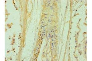 Immunohistochemistry of paraffin-embedded human prostate tissue using ABIN7145641 at dilution of 1:100 (BAMBI Antikörper  (AA 21-152))