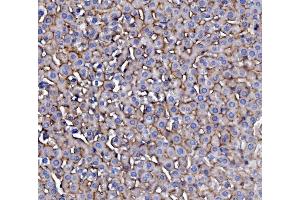 IHC analysis of EGFR using anti-EGFR antibody (ABIN7601478). (EGFR Antikörper  (AA 36-497))