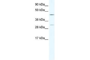 CAMK4 antibody (20R-1131) used at 1. (CAMK4 Antikörper  (C-Term))
