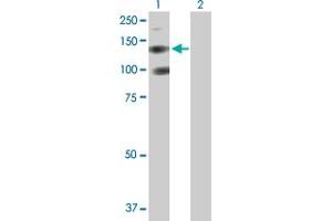 Western Blot analysis of PDGFRA expression in transfected 293T cell line by PDGFRA MaxPab polyclonal antibody. (PDGFRA Antikörper  (AA 1-1089))