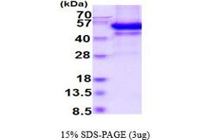 SDS-PAGE (SDS) image for Sparc/osteonectin, Cwcv and Kazal-Like Domains Proteoglycan (Testican) 3 (SPOCK3) (AA 22-436) protein (His tag) (ABIN6387812)