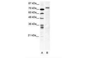 Image no. 1 for anti-Tripartite Motif Containing 9 (TRIM9) (C-Term) antibody (ABIN202749) (TRIM9 Antikörper  (C-Term))
