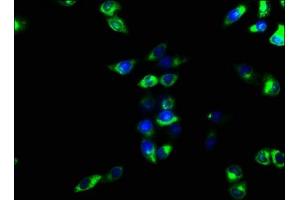 Immunofluorescence staining of Hela cells with ABIN7151367 at 1:166, counter-stained with DAPI. (CD39 Antikörper  (AA 316-474))
