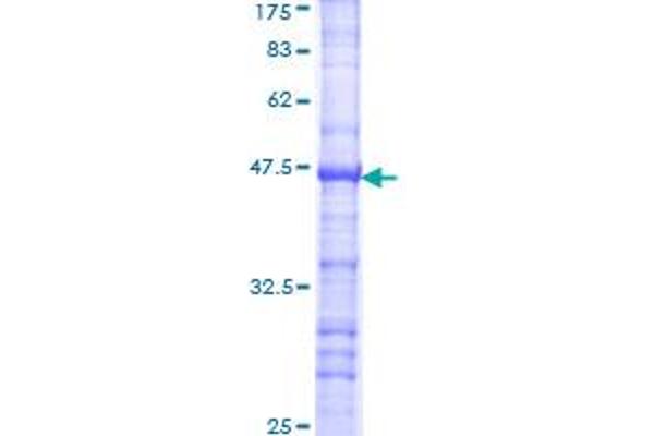 RPS6KB2 Protein (AA 1-100) (GST tag)