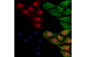 ABIN6257426 and ABIN6275552 staining  cells by IF/ICC. (PPP4R2 Antikörper  (Internal Region))