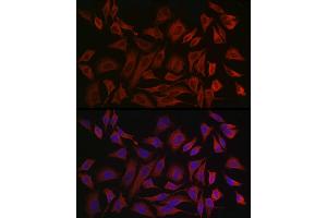 Immunofluorescence (IF) image for anti-Keratin 8 (KRT8) (AA 1-483) antibody (ABIN3021288)