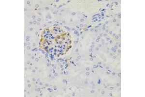 Immunohistochemistry of paraffin-embedded mouse kidney using NPHS1 antibody (ABIN5971560) (40x lens). (Nephrin Antikörper)