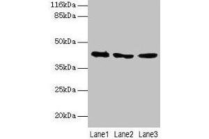 Western blot All lanes: ATXN3 antibody at 2 μg/mL Lane 1: 293T whole cell lysate Lane 2: Mouse brain tissue Lane 3: MCF-7 whole cell lysate Secondary Goat polyclonal to rabbit IgG at 1/10000 dilution Predicted band size: 42, 36, 40, 21 kDa Observed band size: 42 kDa (Ataxin 3 Antikörper  (AA 1-288))