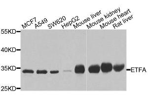 Western blot analysis of extracts of various cell lines, using ETFA antibody. (ETFA Antikörper  (AA 1-333))
