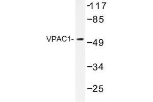 Image no. 1 for anti-Vasoactive Intestinal Peptide Receptor 1 (VIPR1) antibody (ABIN317871)
