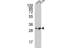 Western Blotting (WB) image for anti-BCL2-Like 11 (Apoptosis Facilitator) (BCL2L11) antibody (ABIN5024165) (BIM Antikörper)