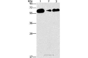 Western blot analysis of Raji, PC3 and lovo cell, using CD27 Polyclonal Antibody at dilution of 1:727 (CD27 Antikörper)