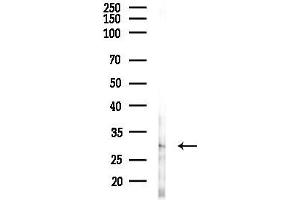 anti-Proenkephalin (PENK) antibody