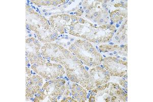 Immunohistochemistry of paraffin-embedded mouse kidney using TARS antibody (ABIN5974207) at dilution of 1/100 (40x lens). (TARS Antikörper)