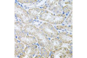 Immunohistochemistry of paraffin-embedded mouse kidney using TARS antibody (ABIN5974207) at dilution of 1/100 (40x lens).