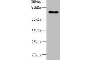 Western blot All lanes: ZNF133 antibody at 5 μg/mL + Hela whole cell lysate Secondary Goat polyclonal to rabbit IgG at 1/10000 dilution Predicted band size: 74, 63, 67 kDa Observed band size: 74 kDa (ZNF133 Antikörper  (AA 1-210))