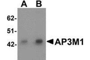Western blot analysis of AP3M1 in human brain tissue lysate with AP3M1 antibody at (A) 1 and (B) 2 μg/ml. (AP3M1 Antikörper  (C-Term))