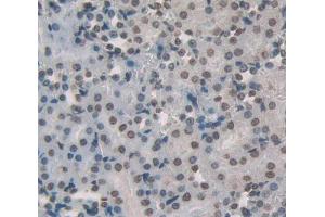 Figure. (PPARA Antikörper  (AA 280-433))