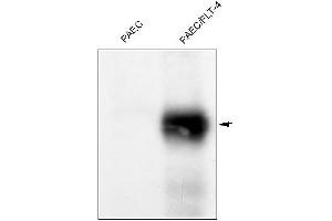 Western Blotting (WB) image for anti-Fms-Related Tyrosine Kinase 4 (FLT4) antibody (ABIN567980) (FLT4 Antikörper)