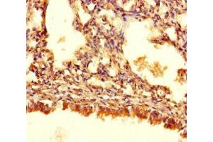 Immunohistochemistry of paraffin-embedded human lung tissue using ABIN7144175 at dilution of 1:100