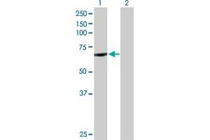 Western Blot analysis of CYP11B1 expression in transfected 293T cell line by CYP11B1 MaxPab polyclonal antibody.