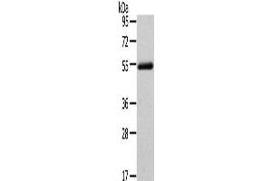 Western Blot analysis of Human normal liver tissue using FOXC1 Polyclonal Antibody at dilution of 1/400 (FOXC1 Antikörper)