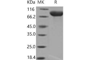 Western Blotting (WB) image for Interleukin 6 Signal Transducer (Gp130, Oncostatin M Receptor) (IL6ST) (Active) protein (His tag) (ABIN7196597)