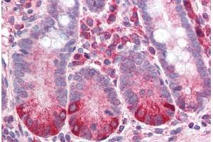 Human Small Intestine (formalin-fixed, paraffin-embedded) stained with IL8RB antibody ABIN337037 at 2. (CXCR2 Antikörper)