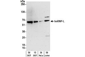 Western Blotting (WB) image for anti-Heterogeneous Nuclear Ribonucleoprotein L (HNRNPL) (C-Term) antibody (ABIN7795592) (HNRNPL Antikörper  (C-Term))