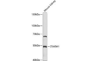 Western blot analysis of extracts of mouse kidney, using ZSWIM1 antibody (ABIN7271563) at 1:1000 dilution.