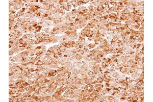 IHC-P Image Immunohistochemical analysis of paraffin-embedded CL1-5 xenograft, using AKR7A3, antibody at 1:100 dilution. (AKR7A3 Antikörper)