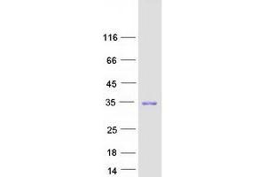 Western Blotting (WB) image for Cyclin-Dependent Kinase Inhibitor 1B (p27, Kip1) (CDKN1B) protein (Myc-DYKDDDDK Tag) (ABIN2713876)