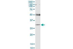 DHDDS antibody  (AA 1-294)