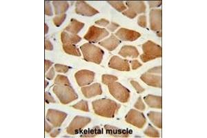 Formalin-fixed and paraffin-embedded human skeletal muscle reacted with PD2 Antibody (Center), which was peroxidase-conjugated to the secondary antibody, followed by DAB staining. (AMPD2 Antikörper  (AA 187-217))