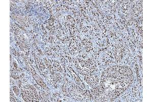 IHC analysis of TRMT6 using anti-TRMT6 antibody (ABIN7602138).