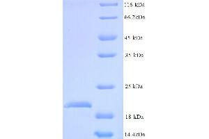 SDS-PAGE (SDS) image for GC-Rich Promoter Binding Protein 1-Like 1 (GPBP1L1) (AA 2-169) protein (His tag) (ABIN5713718) (GPBP1L1 Protein (AA 2-169) (His tag))