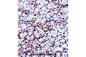Immunohistochemistry (IHC) image for anti-Coiled-Coil Domain Containing 50 (CCDC50) antibody (ABIN2997838) (CCDC50 Antikörper)