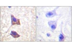 Immunohistochemistry (IHC) image for anti-Interleukin 6 Signal Transducer (Gp130, Oncostatin M Receptor) (IL6ST) (AA 748-797) antibody (ABIN1532554)