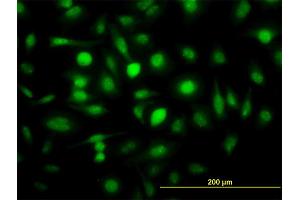 Immunofluorescence of monoclonal antibody to ZWINT on HeLa cell.