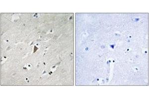 Immunohistochemistry analysis of paraffin-embedded human brain, using PDK1 (Phospho-Tyr9) Antibody. (PDPK1 Antikörper  (pTyr9))