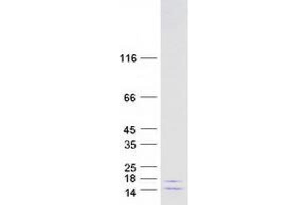 CCDC56 Protein (Myc-DYKDDDDK Tag)