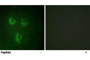 Immunofluorescence analysis of HUVEC cells, using PMEPA1 polyclonal antibody . (PMEPA1 Antikörper)