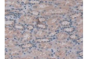 Immunohistochemistry (IHC) image for anti-Guanine Nucleotide Binding Protein (G Protein), beta Polypeptide 1-Like (GNB1L) (AA 69-247) antibody (ABIN7439600)