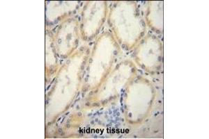 Immunohistochemistry (Paraffin-embedded Sections) (IHC (p)) image for anti-Glucose 6-Phosphatase, Catalytic (G6PC) (AA 123-149) antibody (ABIN651417)
