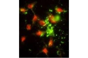 Immunofluorescence analysis of SRP72 Antibody (Center) with hela cells. (SRP72 Antikörper  (AA 119-148))