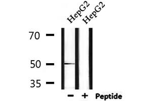 Western blot analysis of extracts from HepG2, using FOXA1 Antibody. (FOXA1 Antikörper  (C-Term))