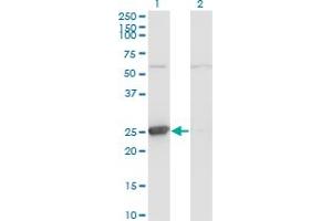 Western Blot analysis of TK1 expression in transfected 293T cell line by TK1 monoclonal antibody (M06), clone 3E2.
