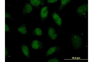 Immunofluorescence of monoclonal antibody to POU5F1 on HeLa cell. (OCT4 Antikörper  (AA 81-164))