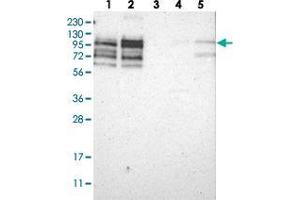 Western blot analysis of Lane 1: RT-4, Lane 2: U-251 MG, Lane 3: Human Plasma, Lane 4: Liver, Lane 5: Tonsil with PPP1R13B polyclonal antibody  at 1:250-1:500 dilution.