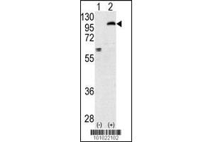 Western blot analysis of PRKCE using rabbit polyclonal PKC epsilon Antibody using 293 cell lysates (2 ug/lane) either nontransfected (Lane 1) or transiently transfected with the PRKCE gene (Lane 2). (PKC epsilon Antikörper  (N-Term))